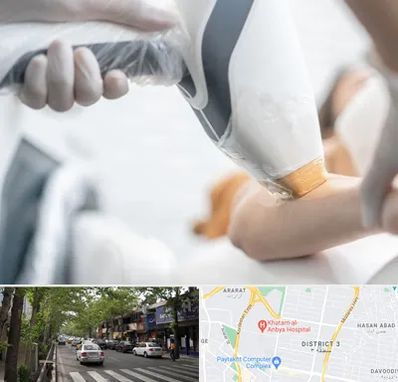 تجهیزات پزشکی زیبایی در ظفر 