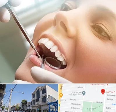 دندانپزشکی زیبایی در افسریه