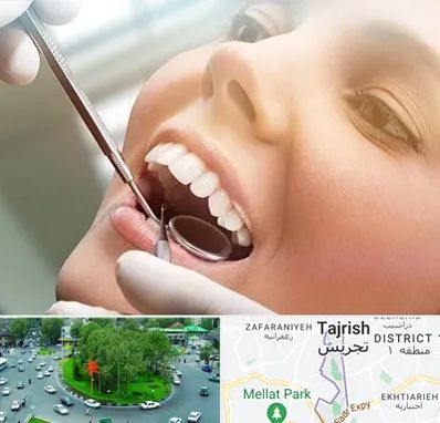 دندانپزشکی زیبایی در تجریش