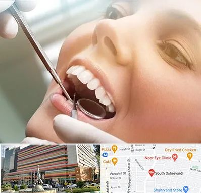 دندانپزشکی زیبایی در سهروردی