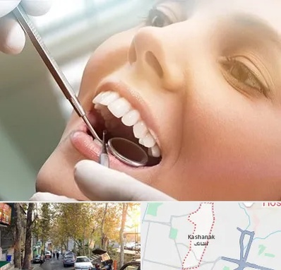 دندانپزشکی زیبایی در کاشانک