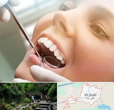 دندانپزشکی زیبایی در علی آباد کتول