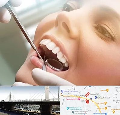 دندانپزشکی زیبایی در پارک وی