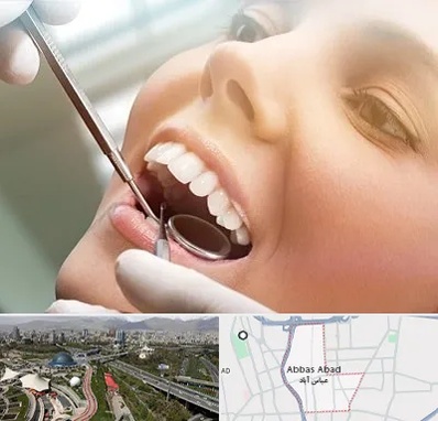 دندانپزشکی زیبایی در عباس آباد تهران