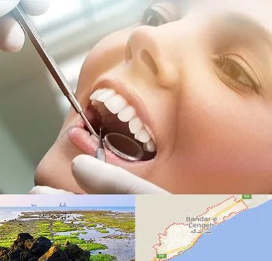دندانپزشکی زیبایی در بندرلنگه