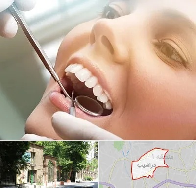دندانپزشکی زیبایی در دزاشیب