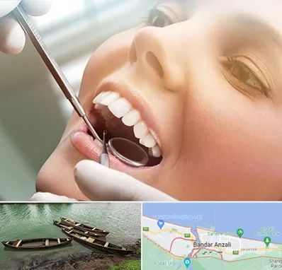 دندانپزشکی زیبایی در بندر انزلی