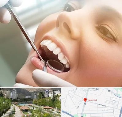 دندانپزشکی زیبایی در بلوار تعاون