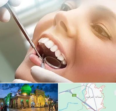 دندانپزشکی زیبایی در آستانه اشرفیه