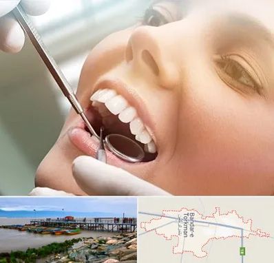 دندانپزشکی زیبایی در بندر ترکمن