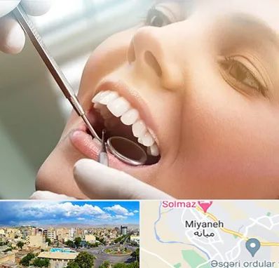 دندانپزشکی زیبایی در میانه