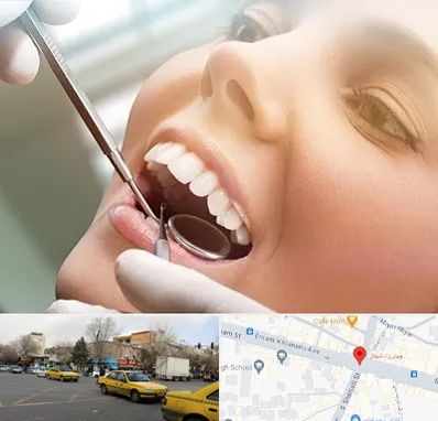 دندانپزشکی زیبایی در شهناز تبریز