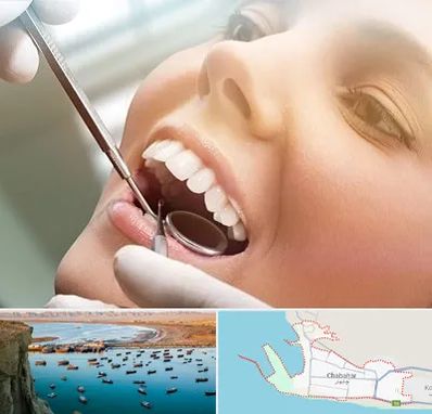دندانپزشکی زیبایی در چابهار