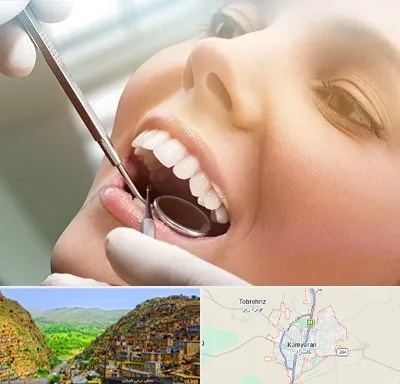 دندانپزشکی زیبایی در کامیاران