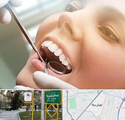 دندانپزشکی زیبایی در تهران ویلا