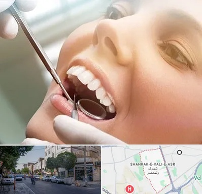 دندانپزشکی زیبایی در شهرک ولیعصر