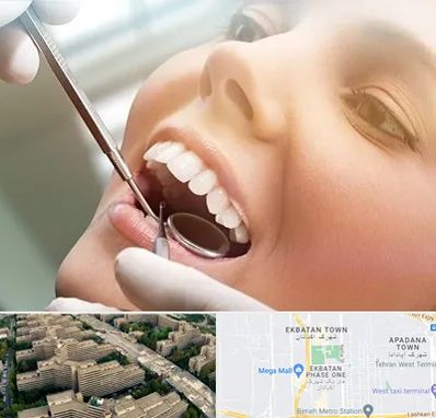 دندانپزشکی زیبایی در اکباتان