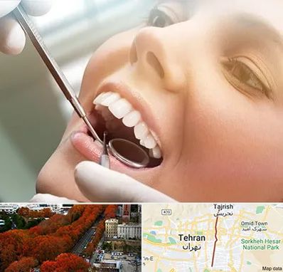 دندانپزشکی زیبایی در ولیعصر