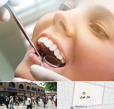 دندانپزشکی زیبایی در بازار تهران