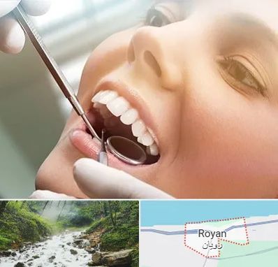 دندانپزشکی زیبایی در رویان