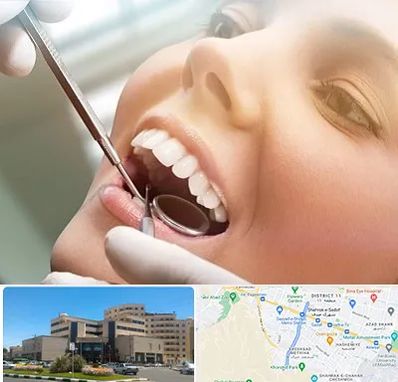 دندانپزشکی زیبایی در صیاد شیرازی مشهد