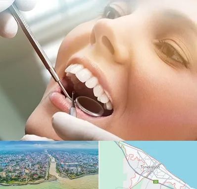 دندانپزشکی زیبایی در تنکابن