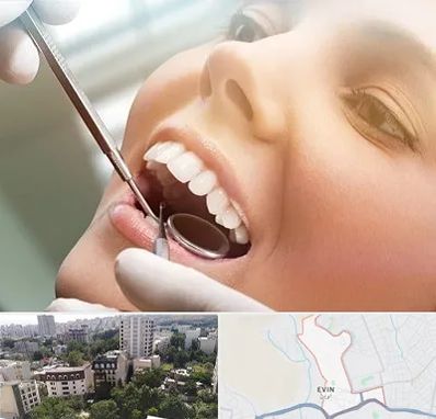 دندانپزشکی زیبایی در اوین