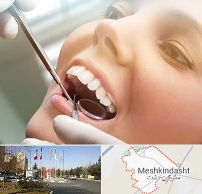 دندانپزشکی زیبایی در مشکین دشت