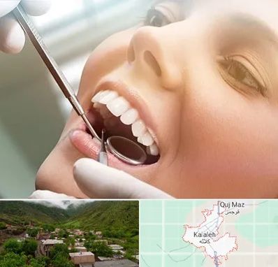 دندانپزشکی زیبایی در کلاله