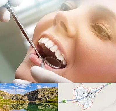 دندانپزشکی زیبایی در فیروزکوه