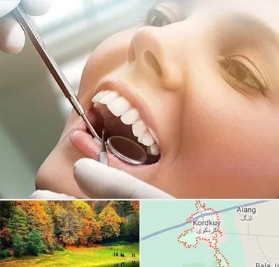 دندانپزشکی زیبایی در کردکوی