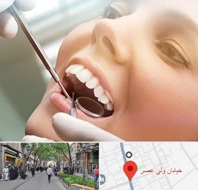 دندانپزشکی زیبایی در ولیعصر شهریار