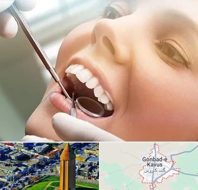 دندانپزشکی زیبایی در گنبد کاووس