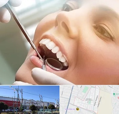 دندانپزشکی زیبایی در فاز دو اندیشه
