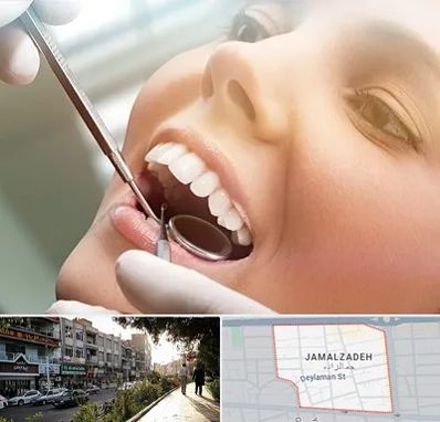 دندانپزشکی زیبایی در خیابان جمالزاده