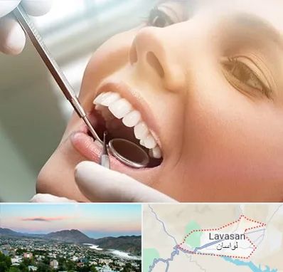دندانپزشکی زیبایی در لواسان