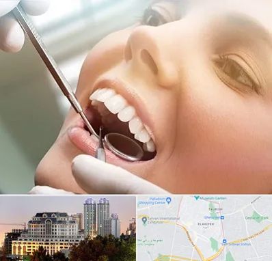 دندانپزشکی زیبایی در فرشته