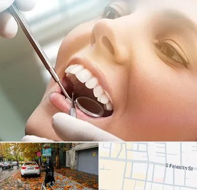 دندانپزشکی زیبایی در خیابان فلسطین