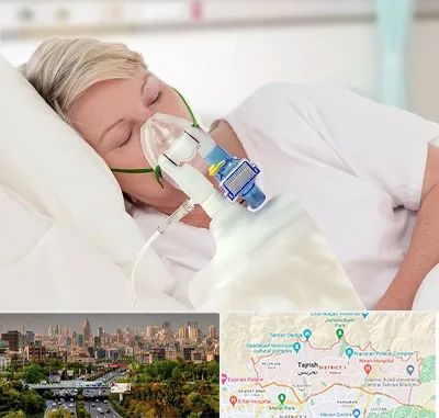 فروش کپسول اکسیژن در منطقه 1 تهران 