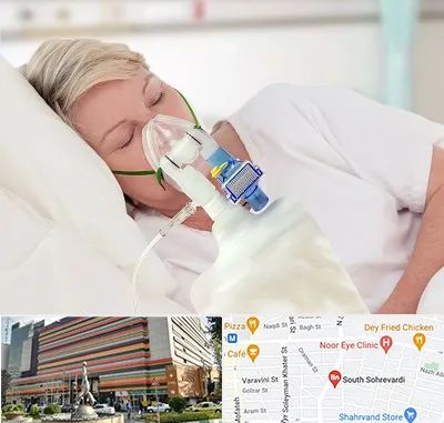 فروش کپسول اکسیژن در سهروردی 