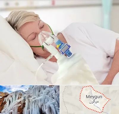 فروش کپسول اکسیژن در میگون