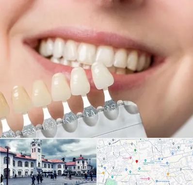 مرکز کامپوزیت دندان در میدان شهرداری رشت