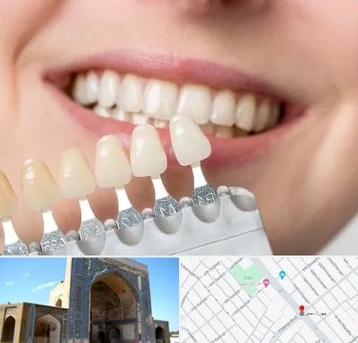 مرکز کامپوزیت دندان در مصلی مشهد