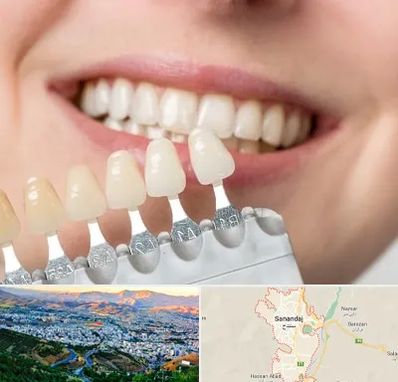 مرکز کامپوزیت دندان در سنندج