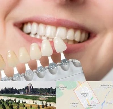 مرکز کامپوزیت دندان در قرچک