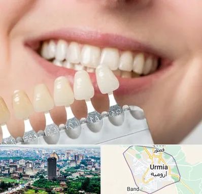 مرکز کامپوزیت دندان در ارومیه