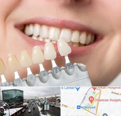 مرکز کامپوزیت دندان در اقدسیه