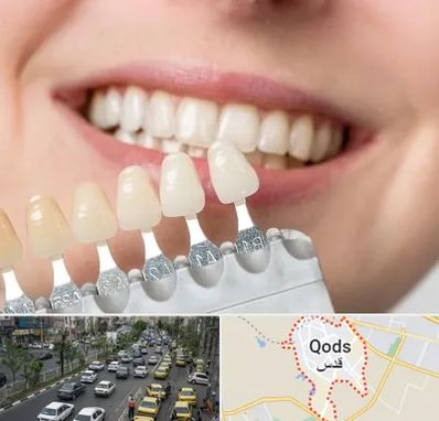 مرکز کامپوزیت دندان در شهر قدس