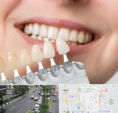 مرکز کامپوزیت دندان در ستارخان