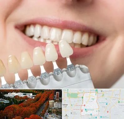 مرکز کامپوزیت دندان در منطقه 6 تهران